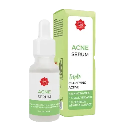 Viva Cosmetics Acne Serum with Triple Clarifying Active for acne-prone skin with niacinamide and BHA