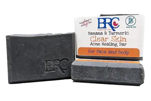 By Robin Creations Clear Skin Acne Healing Bar With Banana & Turmeric